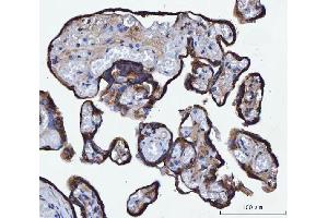 IHC analysis of TMPRSS13 using anti-TMPRSS13 antibody (ABIN7599797). (TMPRSS13 anticorps  (AA 118-572))