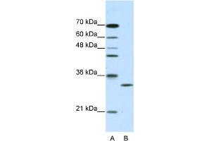 CLIC1 antibody - C-terminal region  validated by WB using purified recombinant CLIC1 protein and transfected lysate (CLIC1 anticorps  (C-Term))