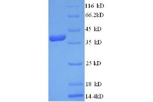 SDS-PAGE (SDS) image for LY6/PLAUR Domain Containing 6 (LYPD6) (AA 23-171) protein (GST tag) (ABIN5711469)