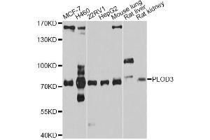 Western blot analysis of extracts of various cell lines, using PLOD3 antibody. (PLOD3 anticorps)