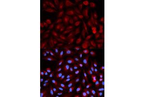Immunofluorescence analysis of HeLa cell using PSME3 antibody. (PSME3 anticorps  (AA 1-254))
