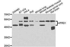 Western blot analysis of extracts of various cell lines, using IFRD1 antibody. (IFRD1 anticorps)