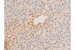 ABIN6267273 at 1/100 staining rat liver tissue sections by IHC-P.