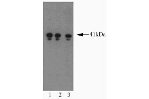 Western blot analysis of AIM-1 on a Jurkat cell lysate (Human T-cell leukemia, ATCC TIB-152). (Aurora Kinase B anticorps  (AA 2-124))