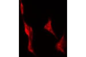 ABIN6278640 staining Hela by IF/ICC. (TAS2R43 anticorps)