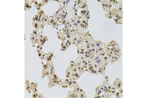Immunohistochemistry of paraffin-embedded rat lung using EGFR antibody. (EGFR anticorps  (AA 1021-1210))