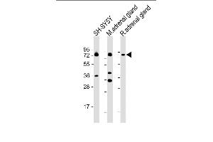 All lanes : Anti-DBH Antibody (N-term P42) at 1:2000 dilution Lane 1: SH-SY5Y whole cell lysate Lane 2: mouse adrenal gland lysate Lane 3: rat adrenal gland lysate Lysates/proteins at 20 μg per lane. (DBH anticorps  (N-Term))