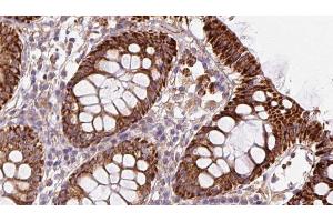 ABIN6272882 at 1/100 staining Mouse colon tissue by IHC-P.