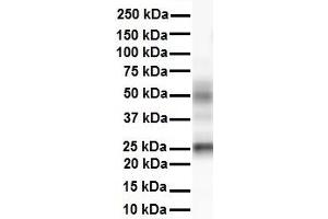 WB Suggested Anti-Tmed1 antibody Titration: 1 ug/mL Sample Type: Human heart (TMED1 anticorps  (N-Term))