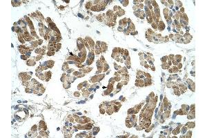 RHOT1 antibody was used for immunohistochemistry at a concentration of 4-8 ug/ml to stain Skeletal muscle cells (arrows) in Human Muscle.