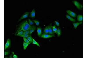 Immunofluorescent analysis of HepG2 cells using ABIN7174961 at dilution of 1:100 and Alexa Fluor 488-congugated AffiniPure Goat Anti-Rabbit IgG(H+L) (Myosin VIIA anticorps  (AA 838-968))