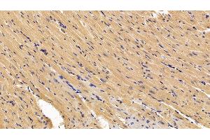 Detection of SOD1 in Rat Cardiac Muscle Tissue using Polyclonal Antibody to Superoxide Dismutase 1 (SOD1) (SOD1 anticorps  (AA 2-154))