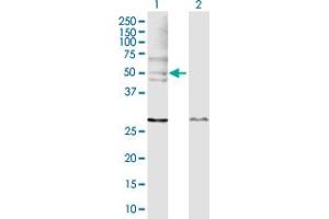 Western Blot analysis of WASL expression in transfected 293T cell line by WASL MaxPab polyclonal antibody. (Neural Wiskott-Aldrich syndrome protein (WASL) (AA 1-505) anticorps)
