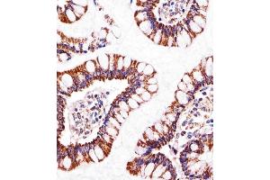 Immunohistochemical analysis of paraffin-embedded H. (ATP5B anticorps  (AA 135-163))