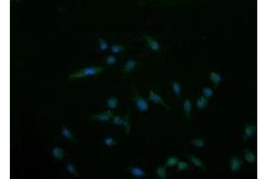Image no. 1 for anti-Cancer/testis Antigen 1B (CTAG1B) antibody (ABIN1499903) (CTAG1B anticorps)