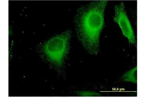 Immunofluorescence of monoclonal antibody to STAB1 on HeLa cell.
