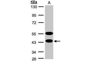 WB Image Sample(30 ug whole cell lysate) A:MOLT4 , 10% SDS PAGE antibody diluted at 1:1000 (CABS1 anticorps  (Center))