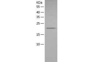 Western Blotting (WB) image for Myosin, Light Chain 2, Regulatory, Cardiac, Slow (MYL2) (AA 1-166) protein (His tag) (ABIN7124006)