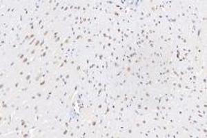 Immunohistochemistry analysis of paraffin-embedded mouse heart using,Ring1A (ABIN7075467) at dilution of 1: 3600