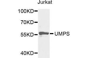 Western blot analysis of extracts of Jurkat cells, using UMPS antibody (ABIN5973202) at 1/1000 dilution. (UMPS anticorps)