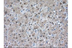 Immunohistochemical staining of paraffin-embedded Human prostate tissue using anti-PDE4A mouse monoclonal antibody. (PDE4A anticorps)