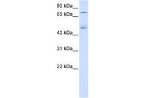 Image no. 1 for anti-DEAD (Asp-Glu-Ala-Asp) Box Polypeptide 1 (DDX1) (AA 36-85) antibody (ABIN6740488) (DDX1 anticorps  (AA 36-85))