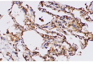 Immunohistochemistry of paraffin-embedded Human lung using FGA Polycloanl Antibody at dilution of 1:100 (FGA anticorps)