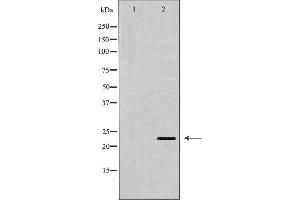 Western blot analysis of extracts of MCF7, using BAK1 antibody. (BAK1 anticorps  (N-Term))