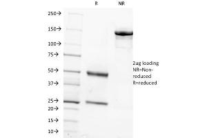 SDS-PAGE Analysis Purified FSH beta Mouse Monoclonal Antibody (FSHb/1062). (FSHB anticorps)