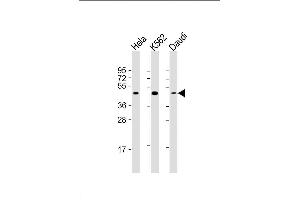 Lane 1: HeLa Cell lysates, Lane 2: K562 Cell lysates, Lane 3: Daudi Cell lysates, probed with PLIN3 (1651CT157. (PLIN3 anticorps)