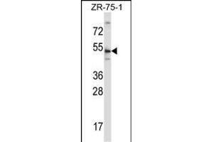 TERF2 Antibody (Center) (ABIN657781 and ABIN2846755) western blot analysis in ZR-75-1 cell line lysates (35 μg/lane). (TRF2 anticorps  (AA 308-337))