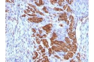 Formalin-fixed, paraffin-embedded rat uterus stained with Calponin antibody (CNN1/832 + CALP). (Calponin anticorps)