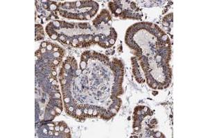 Immunohistochemical staining of human colon with EFR3A polyclonal antibody  shows srrong cytoplasmic positivity with granular pattern in glandular cells at 1:20-1:50 dilution. (EFR3A anticorps)