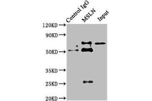 Immunoprecipitating MSLN in HepG2 whole cell lysate Lane 1: Rabbit control IgG instead of ABIN7159428 in HepG2 whole cell lysate. (Mesothelin anticorps  (AA 37-598))