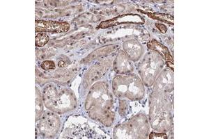Immunohistochemical staining of human kidney with TSSC4 polyclonal antibody  shows strong cytoplasmic and moderate nuclear positivity in subsets of tubules at 1:1000-1:2500 dilution. (TSSC4 anticorps)