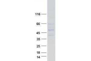 Validation with Western Blot