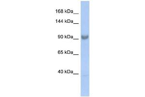 WB Suggested Anti-SART3 Antibody Titration:  0.