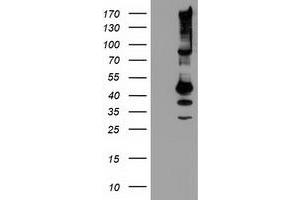 Western Blotting (WB) image for anti-serpin Peptidase Inhibitor, Clade B (Ovalbumin), Member 13 (SERPINB13) antibody (ABIN1500881)