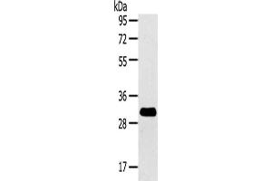 Gel: 8 % SDS-PAGE,Lysate: 40 μg,Primary antibody: ABIN7192139(RalA Antibody) at dilution 1/200 dilution,Secondary antibody: Goat anti rabbit IgG at 1/8000 dilution,Exposure time: 2 minutes (rala anticorps)