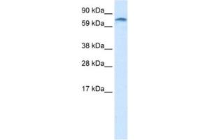 Western Blotting (WB) image for anti-Zinc Finger Protein 84 (ZNF84) antibody (ABIN2461187)