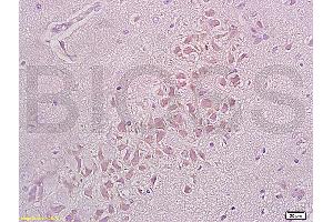 Formalin-fixed and paraffin embedded rat brain tissue labeled with Anti-Integrin beta 1/CD29 Polyclonal Antibody (ABIN669216), Unconjugated at 1:200, followed by conjugation to the secondary antibody and DAB staining (ITGB1 anticorps  (AA 25-100))