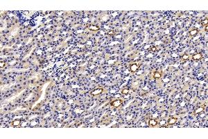 Detection of CK18 in Rat Kidney Tissue using Polyclonal Antibody to Cytokeratin 18 (CK18)