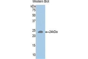 Detection of recombinant HLA-DRA using Polyclonal Antibody to HLA Class II Histocompatibility Antigen, DR Alpha Chain (HLA-DRA) (HLA-DRA anticorps  (AA 26-216))