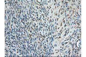 Immunohistochemical staining of paraffin-embedded colon using anti-Trim33 (ABIN2452535) mouse monoclonal antibody. (TRIM33 anticorps  (AA 887-1046))