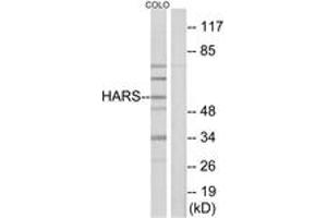 Western blot analysis of extracts from COLO cells, using HARS Antibody. (HARS1/Jo-1 anticorps  (AA 460-509))