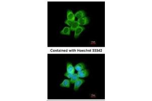 ICC/IF Image Immunofluorescence analysis of methanol-fixed A431, using AKR1C1, antibody at 1:200 dilution.