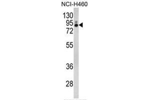 Western blot analysis of PLA2G4A Antibody (Center) in NCI-H460 cell line lysates (35ug/lane). (PLA2G4A anticorps  (Middle Region))
