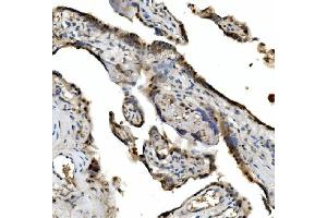 IHC analysis of VPRBP/DCAF1 using anti-VPRBP/DCAF1 antibody (ABIN7599063). (DDB1 and CUL4-Associated Factor 1 (DCAF1) (AA 1-195) anticorps)