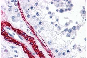 Human Testis: Formalin-Fixed, Paraffin-Embedded (FFPE) (CARD10 anticorps  (N-Term))