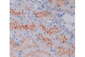 IHC-P analysis of kidney tissue, with DAB staining. (CAMK1 anticorps  (AA 1-370))